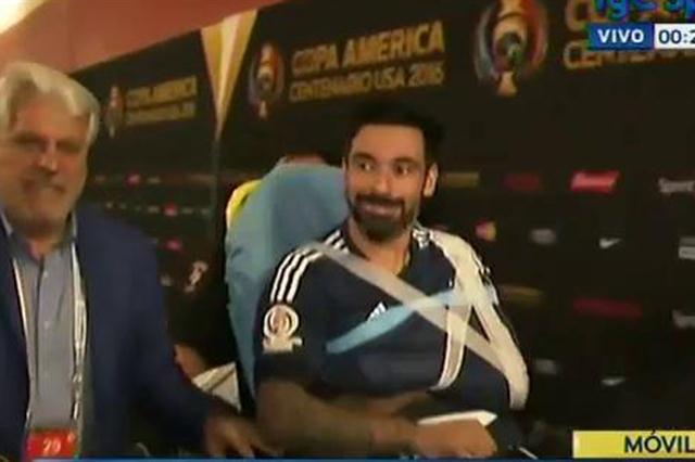 Así quedó el brazo de Lavezzi tras su espectacular caída - ezequiel-lavezzi-1