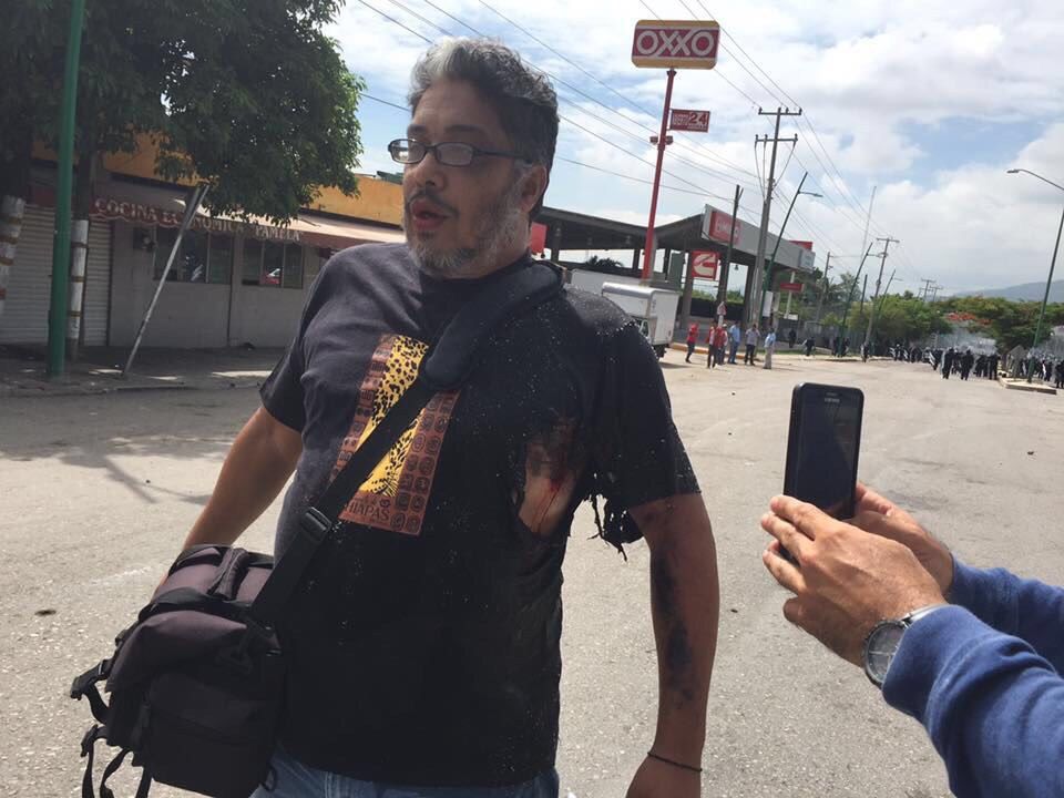Periodista herido en enfrentamiento de maestros y policías en Tuxtla Gutiérrez - periodista-chiapas
