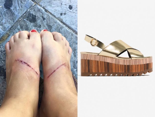 Mujer acusa a Zara de quemarle los pies - sandalias-