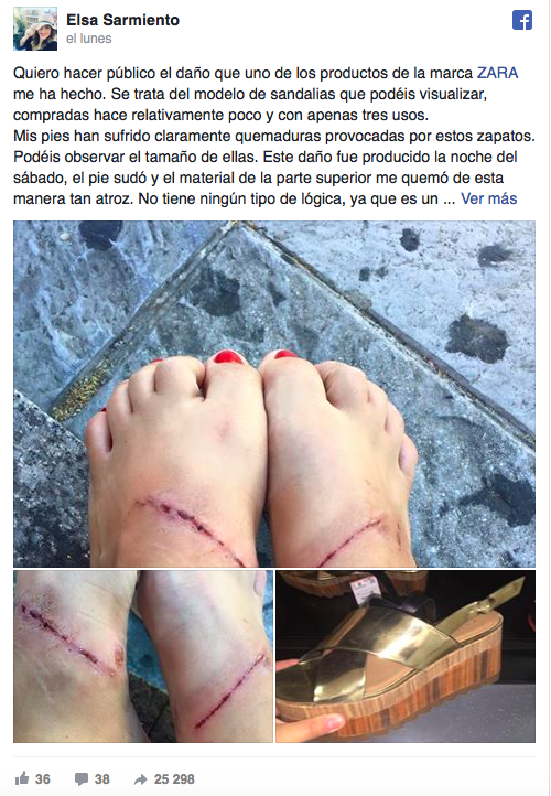 Mujer acusa a Zara de quemarle los pies - sandalias