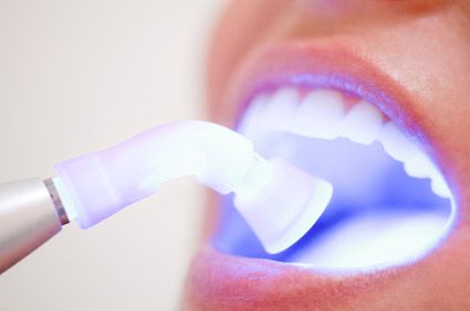 Blanqueamiento dental solo debe hacerse con expertos: IMSS - blanqueado