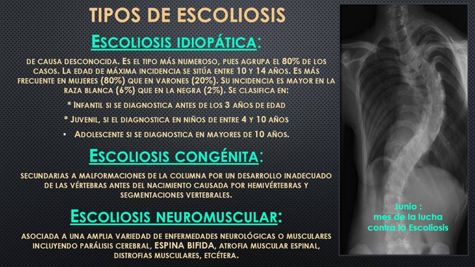 Padres buscan apoyos para seguir con el tratamiento para su hijo de 3 años - escoliosis