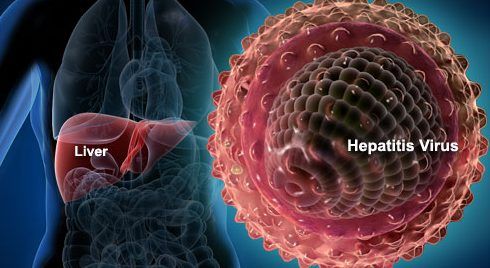 Hepatitis viral: principal causa de muerte en el mundo Hepatitis viral: principal causa de muerte en el mundo
