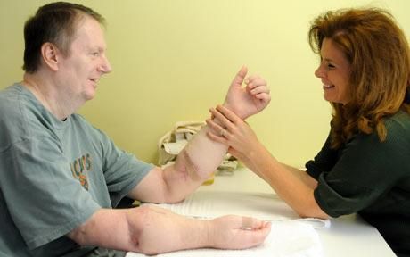 Hombre que recibió el primer trasplante de manos pide que se las quiten