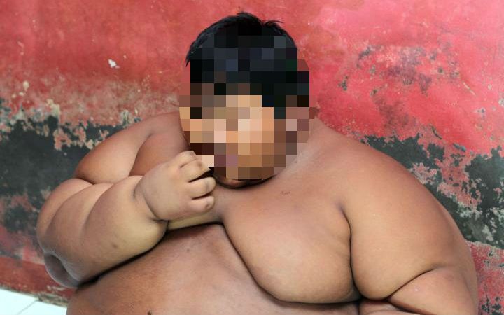 A dieta el niño más obeso del mundo