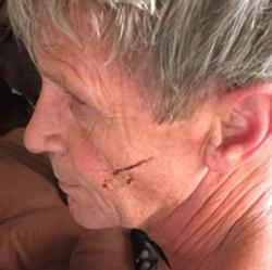 #VIRAL: exboxeador vence a oso - rick-nelson-2