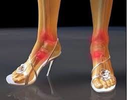 Los riesgos de usar tacones - tacones-2