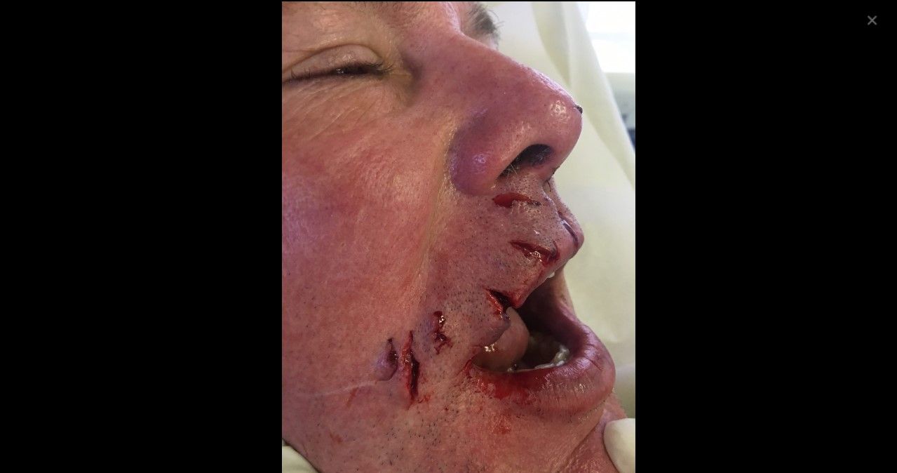 Hombre pelea contra un tiburón en Bahamas