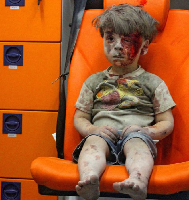 Omran Daqneesh es la cara de la guerra en Siria - 14718781876116-1