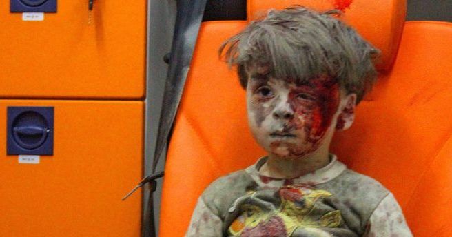 Omran Daqneesh es la cara de la guerra en Siria