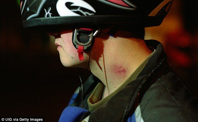 "Chupetón" en el cuello mata a joven en México - 37A4825C00000578-3761887-A_17_year_old_boy_from_Mexico_City_died_after_a_hickey_on_his_ne-m-32_1472342296869