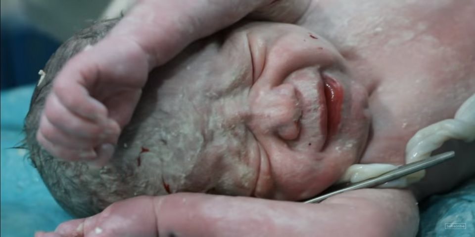 Video: el dramático nacimiento de un bebé en medio de la guerra