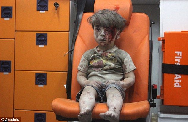 Muere el hermano de Omran Daqneesh, el niño del bombardeo de Alepo