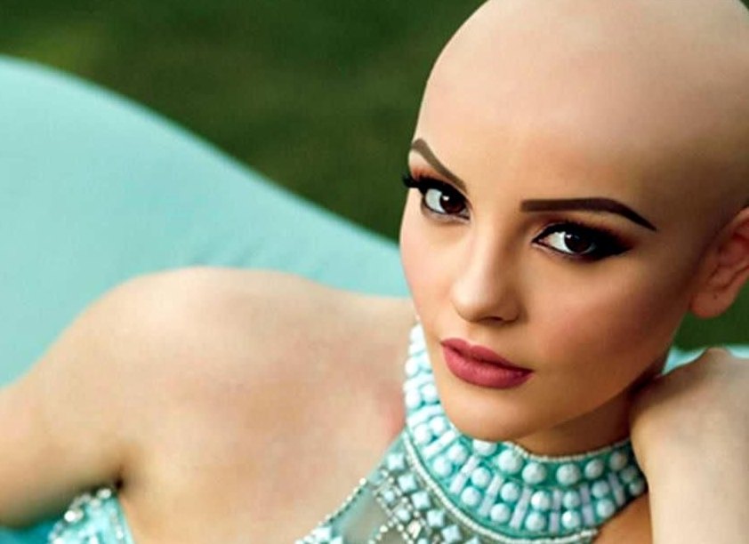 Modelo mexicana se vuelve imagen de la lucha contra el cáncer - andrea-2