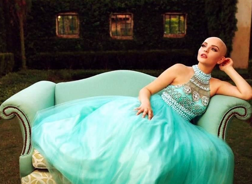 Modelo mexicana se vuelve imagen de la lucha contra el cáncer
