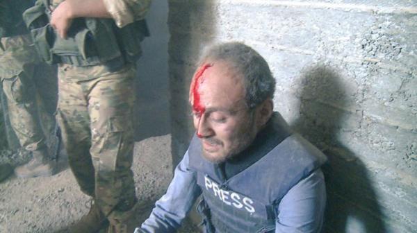 Video: periodista estuvo cerca de ser impactado por una bomba en Siria - descarga-7