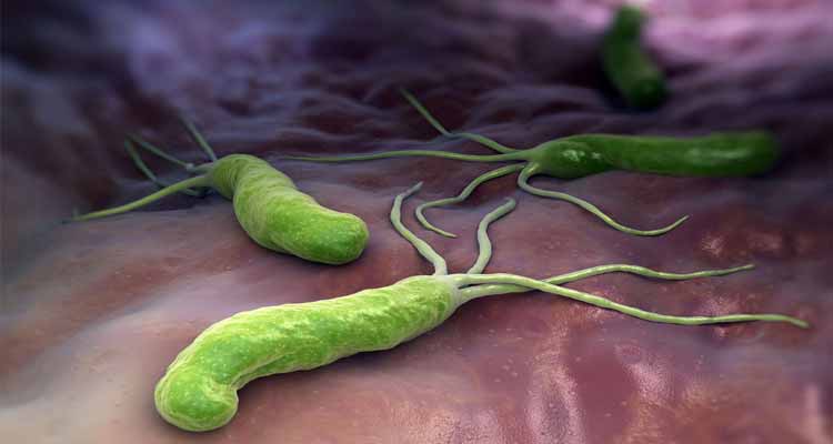 Más de la mitad de la población mexicana padece de Helicobacter Pylori