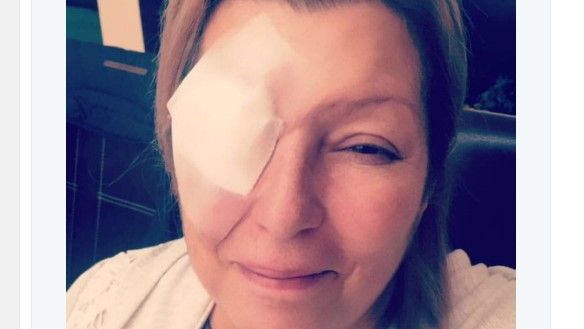 Margarita la ‘Diosa de la Cumbia’ sufre accidente en un ojo