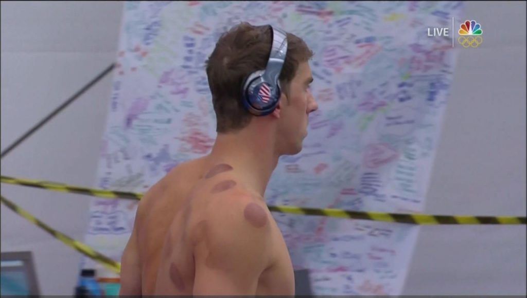 ¿Qué eran esas marcas moradas en el cuerpo de Michael Phelps? - michael-phelps-1024x580