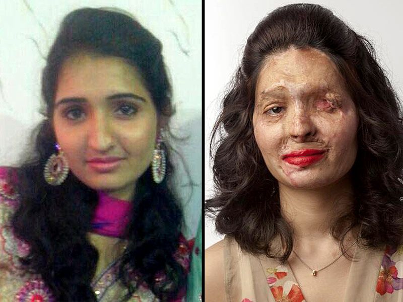 Víctima de ataque con ácido desfilará en el Fashion Week New York - reshma-800