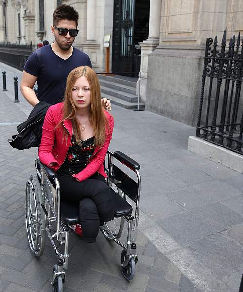 Mujer en Perú pierde extremidades por negligencia médica - sheryl-meléndez