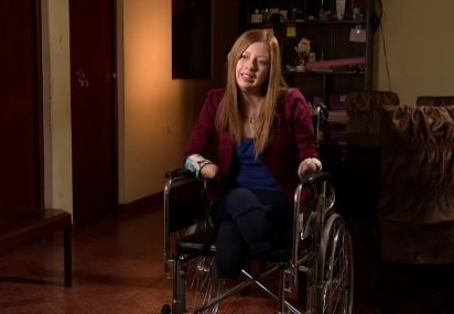 Mujer en Perú pierde extremidades por negligencia médica