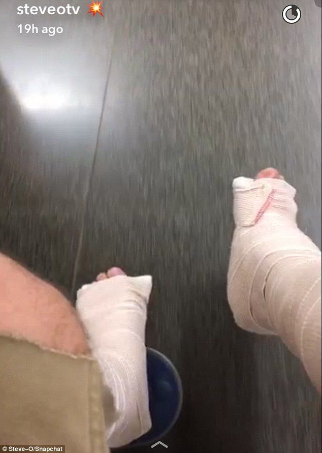 Video: actor de Jackass se rompe las dos piernas por truco en patineta - steve-o-piernas