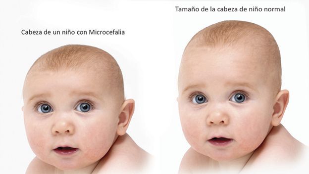 Texas reporta primera muerte por Zika - zika-2