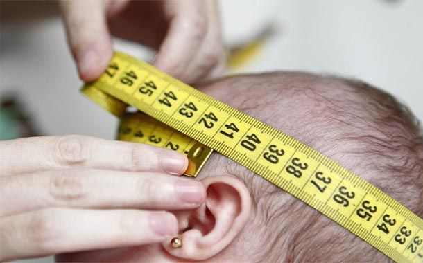 Texas reporta primera muerte por Zika - zika