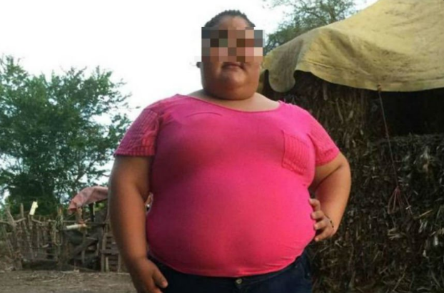 Evolución positiva de la menor con sobrepeso - Captura-de-pantalla-2016-09-16-a-las-13.06.28