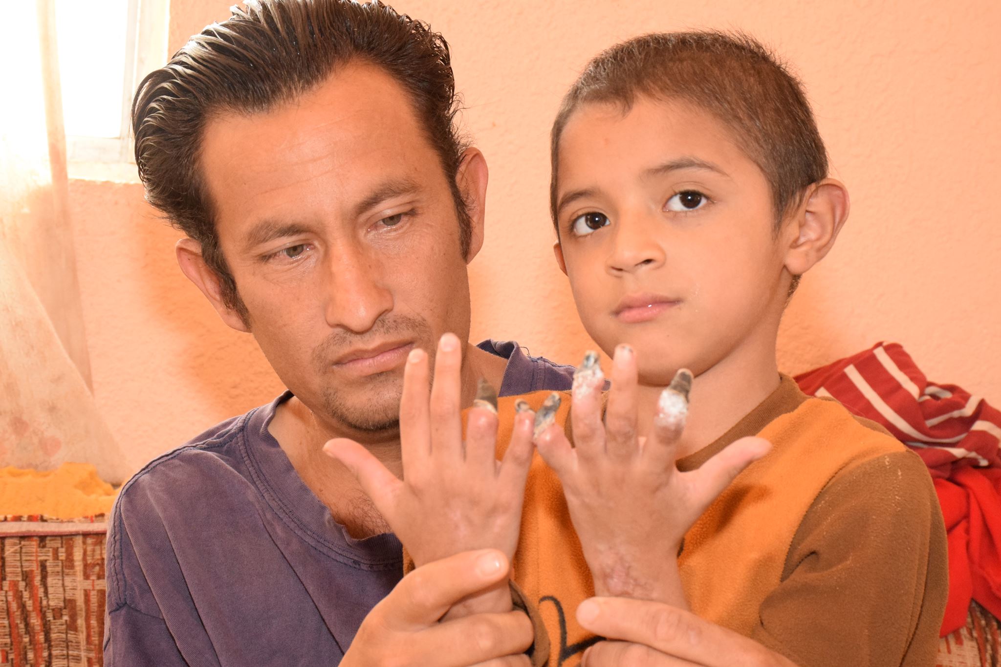 Medicamento no provocó pérdida de dedos a menor en Chihuahua: IMSS