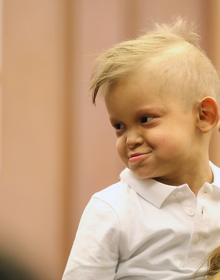 ISSSTE diseña prótesis dentales totales a niño con alteración genética - IMG_8557