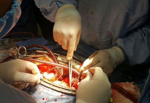 Aumenta el número de afiliados al IMSS - IMSS-III