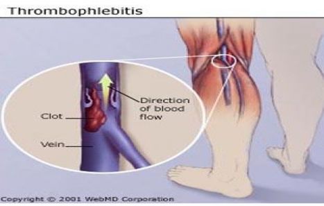 Darwin Quintero podría perderse el resto del torneo - b12f5681b442015ddaa57598066d483c