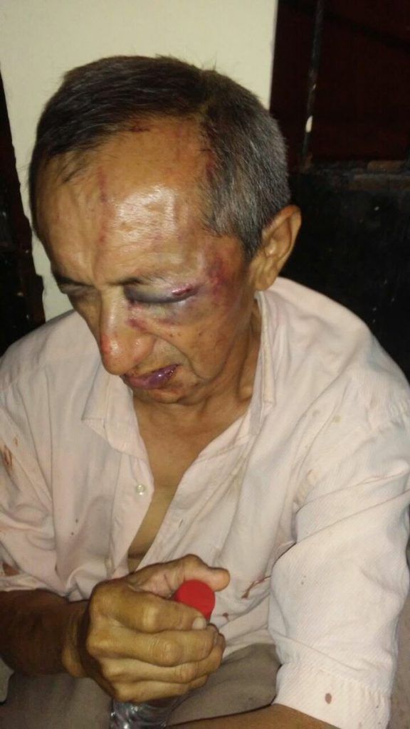 Golpean a chofer de Uber e incendian su auto en Yucatán - conductor-uber-yucatan-576x1024