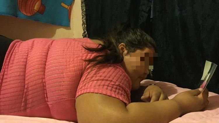 Niña de 14 años y 195 kilos de peso espera que un bypass gástrico le cambie la vida