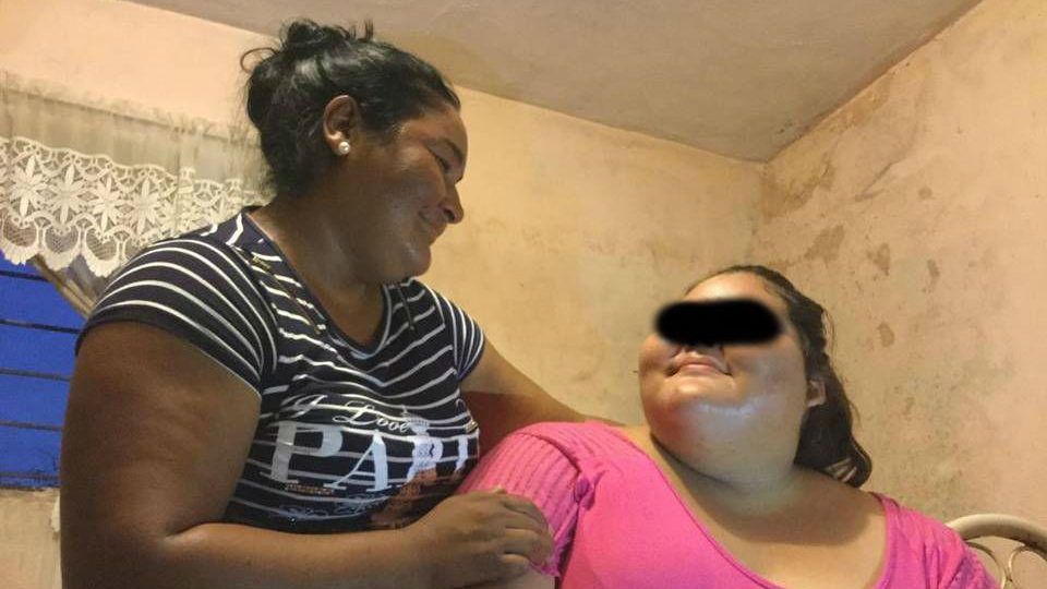 Evolución positiva de la menor con sobrepeso