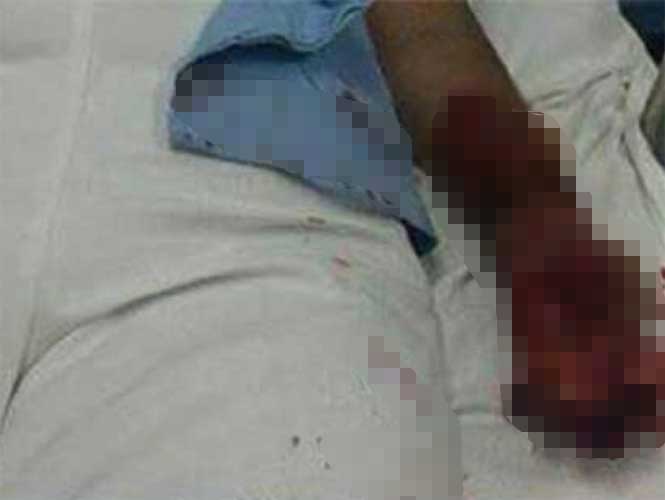 Padre golpea con mazo a enfermera que hizo llorar a su hija