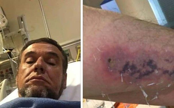 El mago Frank en riesgo de muerte por mordedura de araña - mago-picasdo