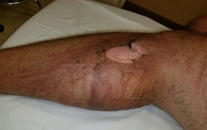 Usuario demanda a Samsung por explosión