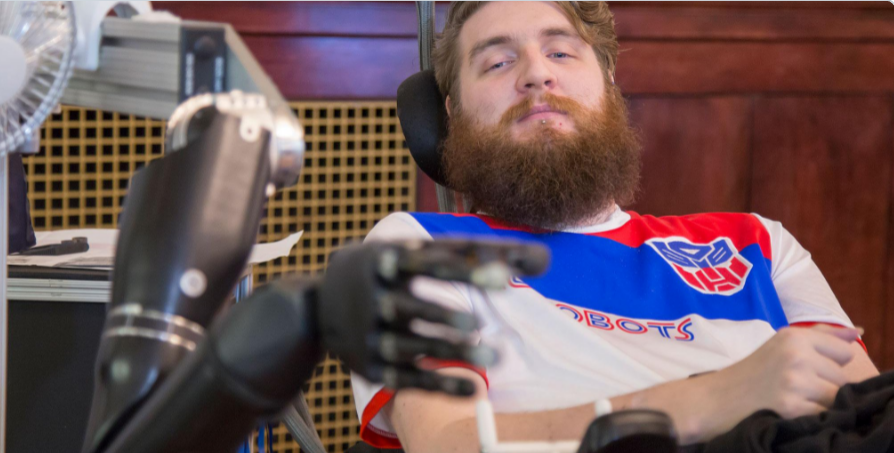 Video: hombre paralítico recupera sentido del tacto con mano robótica - Captura-de-pantalla-2016-10-13-a-las-14.27.47