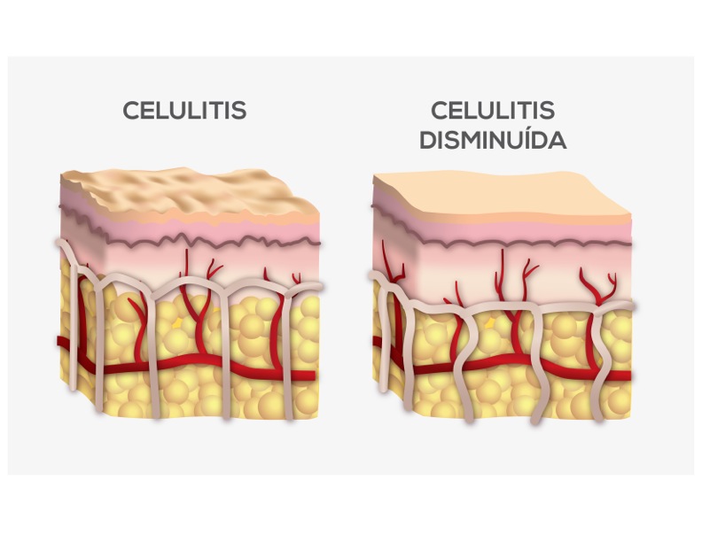 La ciencia de las terapias de calor infrarrojo lejano y la eliminación de toxinas - Grafica13