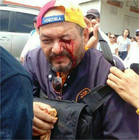 Al menos 140 detenidos y 20 heridos por las marchas en Venezuela - Venezuela-7