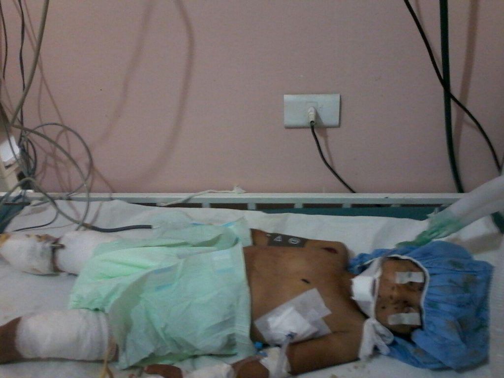 Muere niña de cuatro años que confundió bomba con juguete - emam-alepo-1024x768