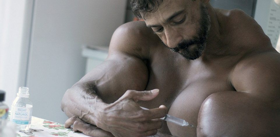 ‘Hulk humano’ adicto al Synthol prefiere perder los brazos a dejar de inyectarse