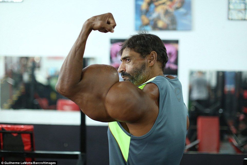 ‘Hulk humano’ adicto al Synthol prefiere perder los brazos a dejar de inyectarse - hulk-07