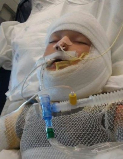 Acusan a menor de quemar a un niño de 10 años en Texas - kayden-culpI