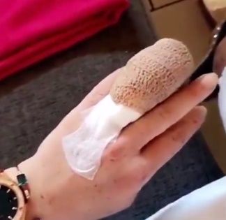 Lindsay Lohan pierde la mitad del dedo en accidente - lindsay-dedo