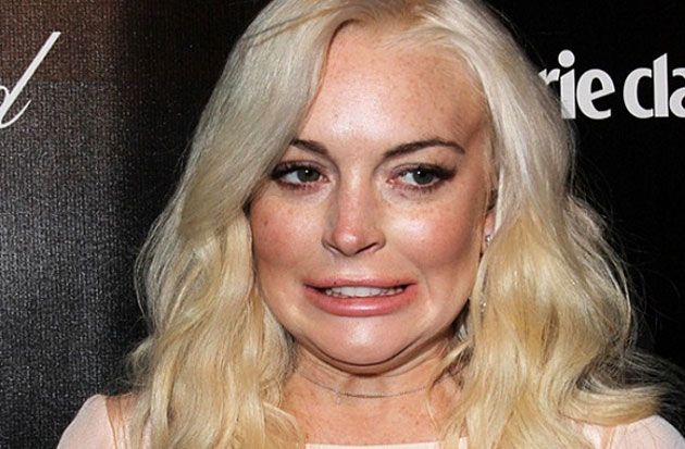 Lindsay Lohan pierde la mitad del dedo en accidente
