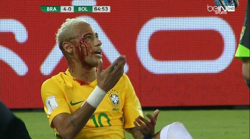 Video: golpean a Neymar y lo dejan sangrando - neymar-2
